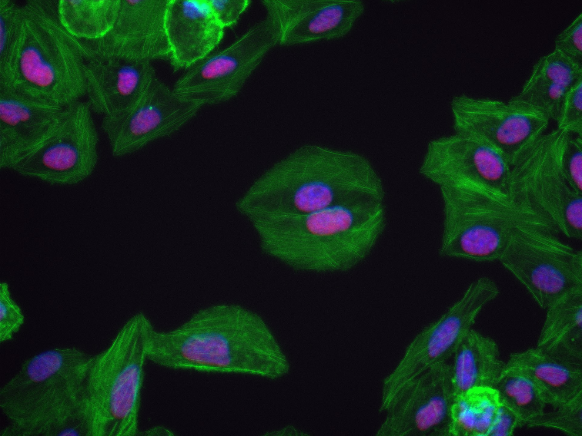 IF Staining of U2OS using 82852-3-RR