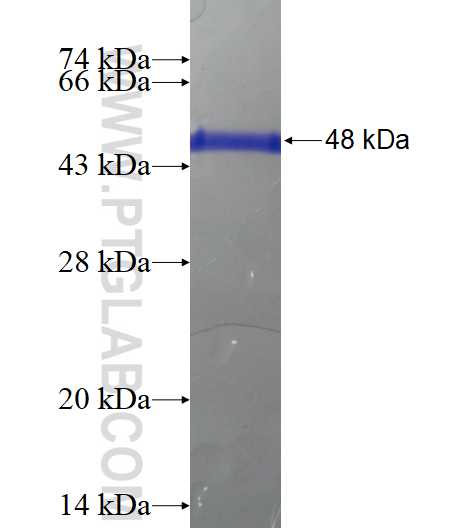 MAZ fusion protein Ag15200 SDS-PAGE