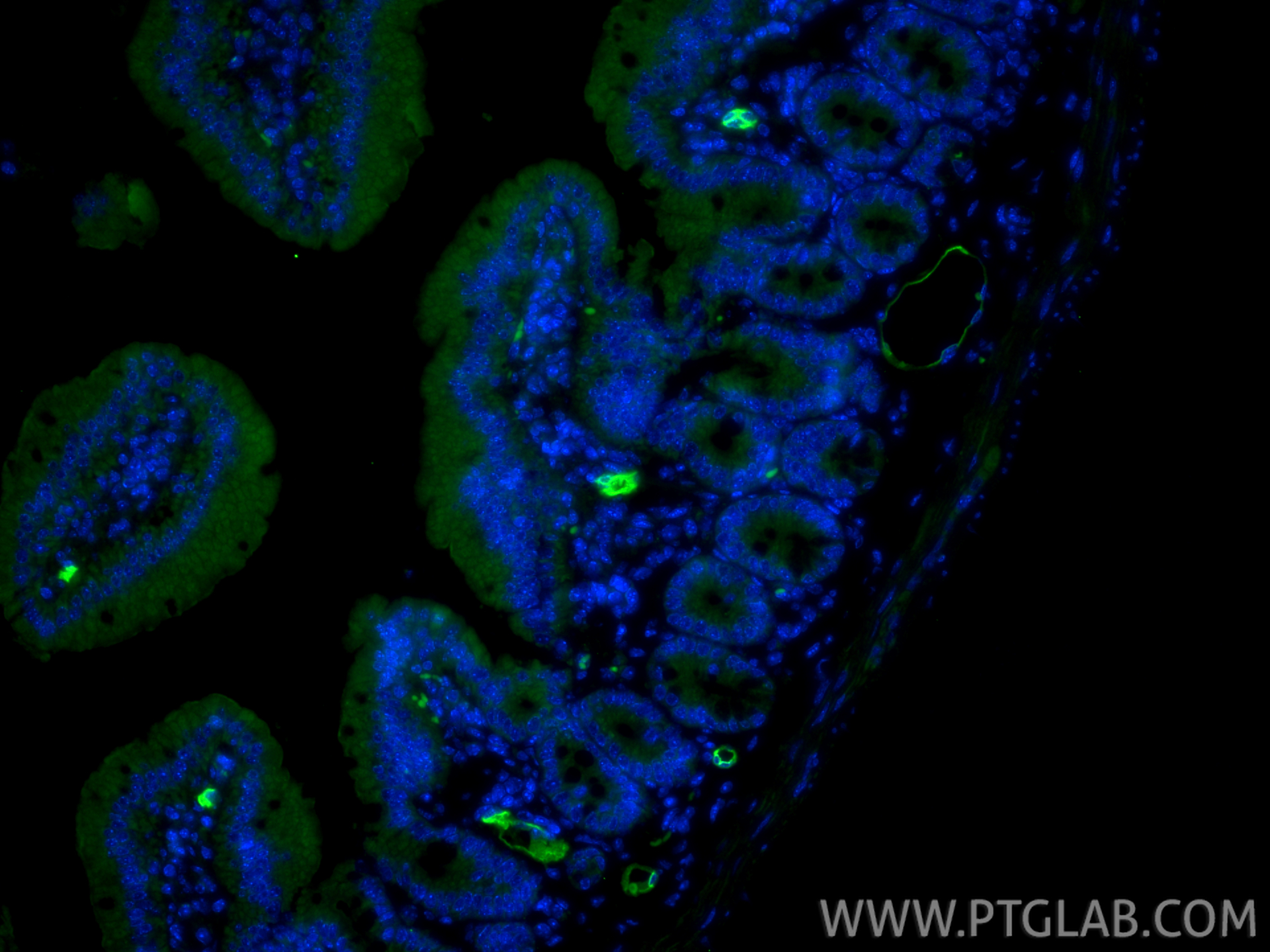 IF Staining of mouse small intestine using 32526-1-AP