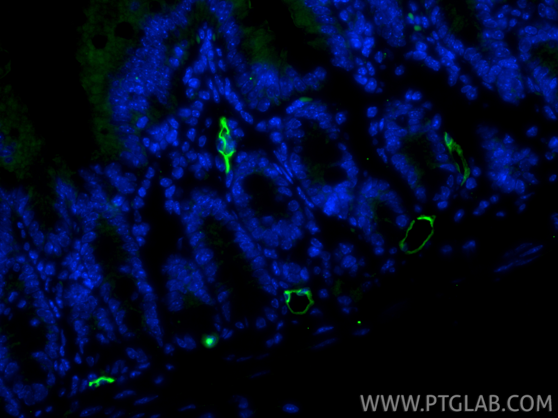 IF Staining of mouse small intestine using 32526-1-AP