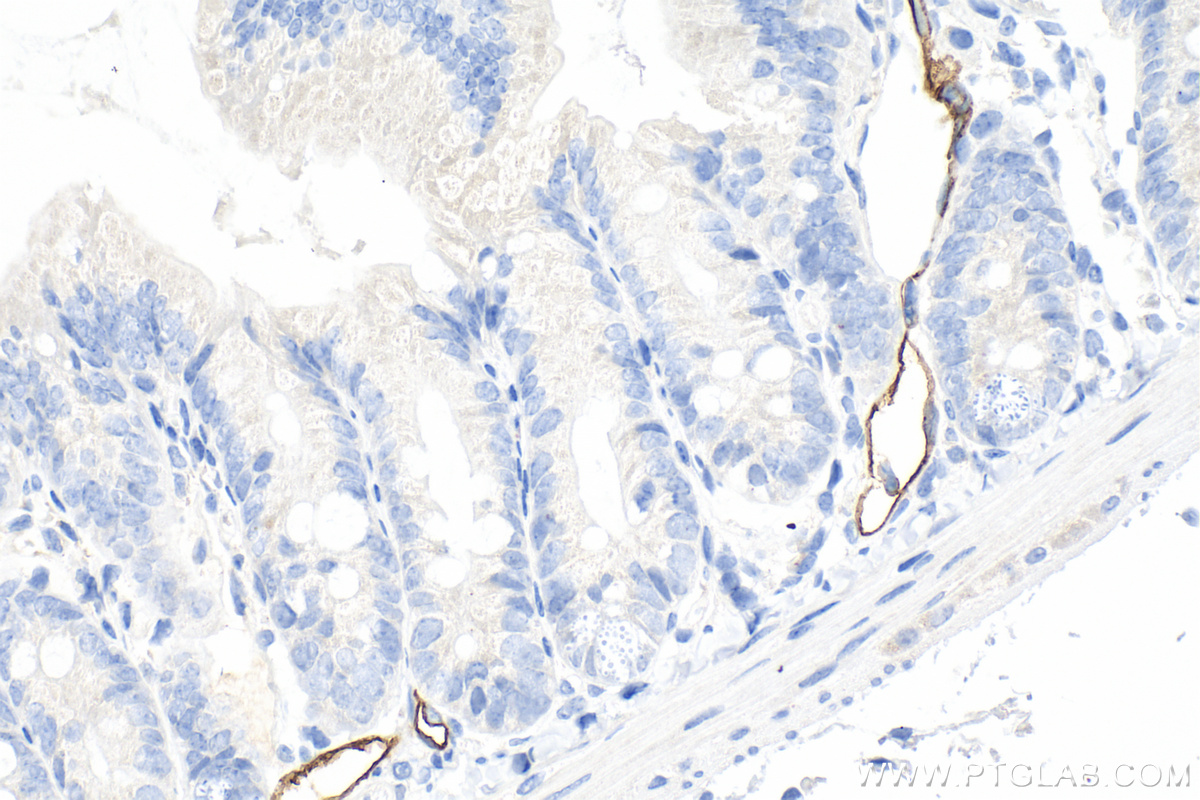IHC staining of mouse small intestine using 32526-1-AP