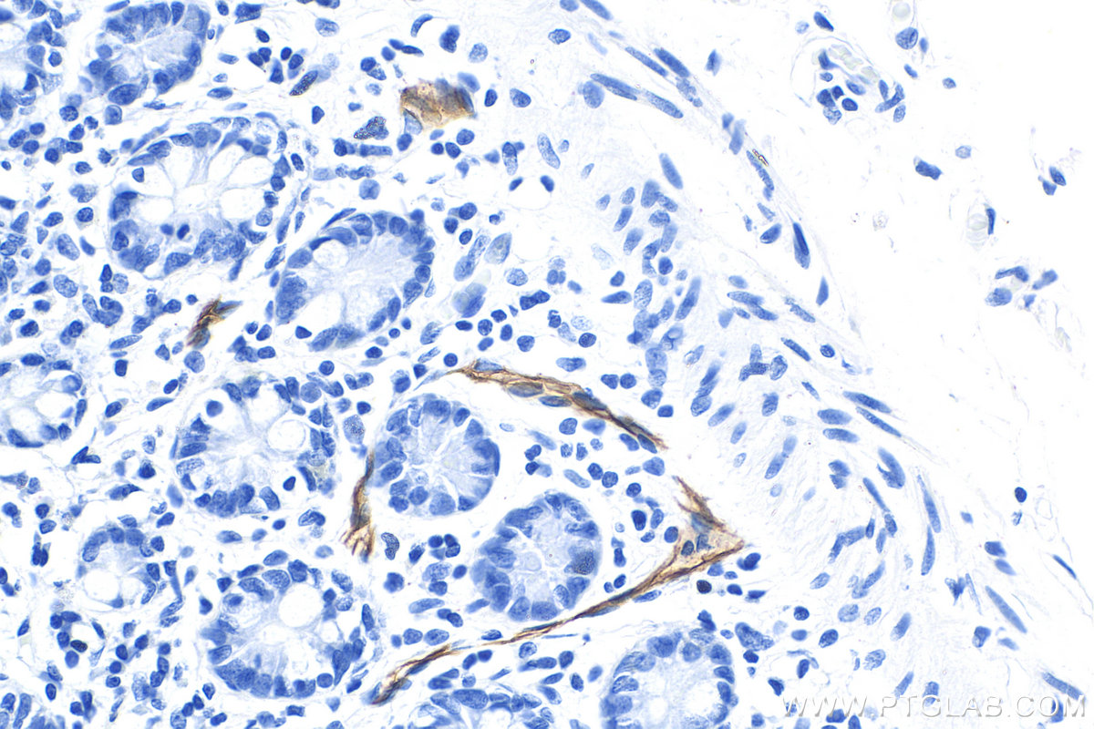 IHC staining of human small intestine using Biotin-66594