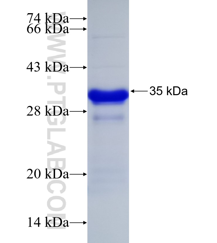 MBD1 fusion protein Ag32852 SDS-PAGE