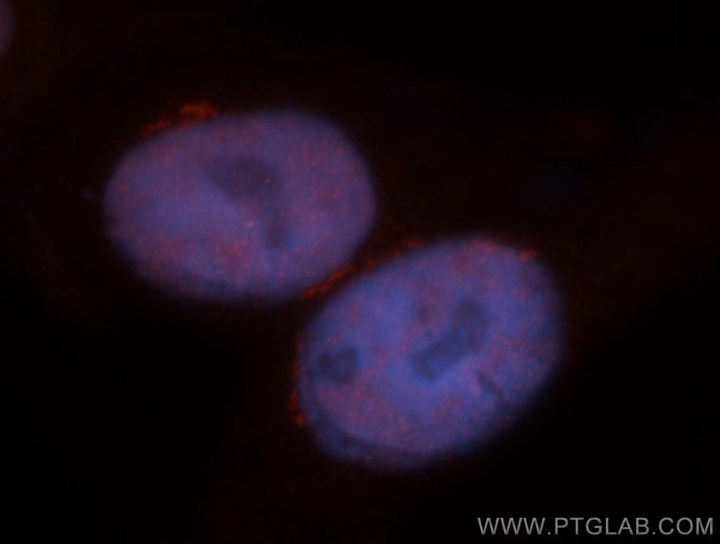 IF Staining of HepG2 using 14258-1-AP