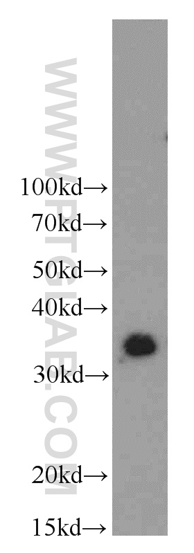 WB analysis of Y79 using 14258-1-AP