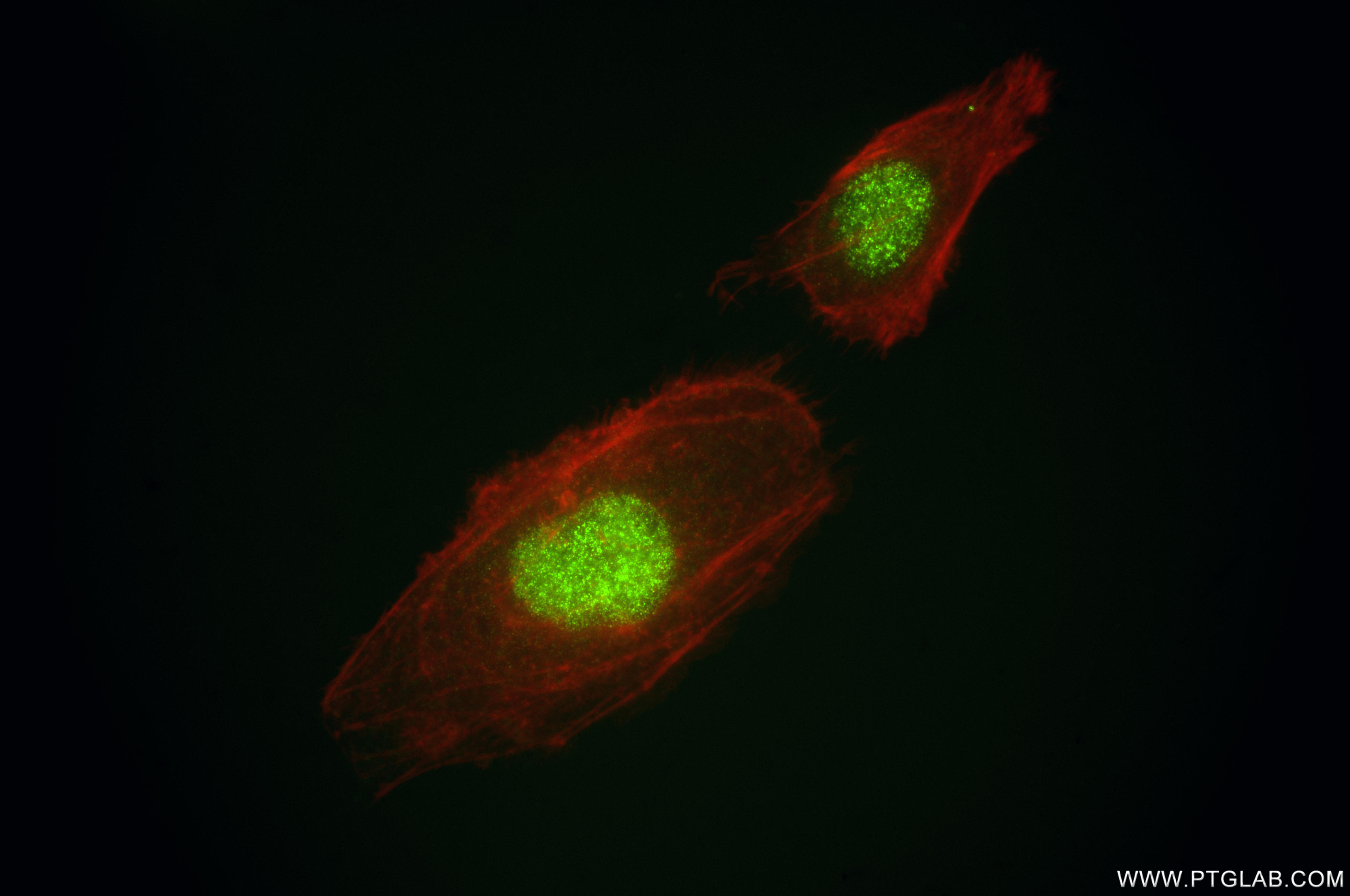 IF Staining of HeLa using 86681-2-RR (same clone as 86681-2-PBS) IF Staining of HeLa using 86681-2-RR (same clone as 86681-2-PBS)