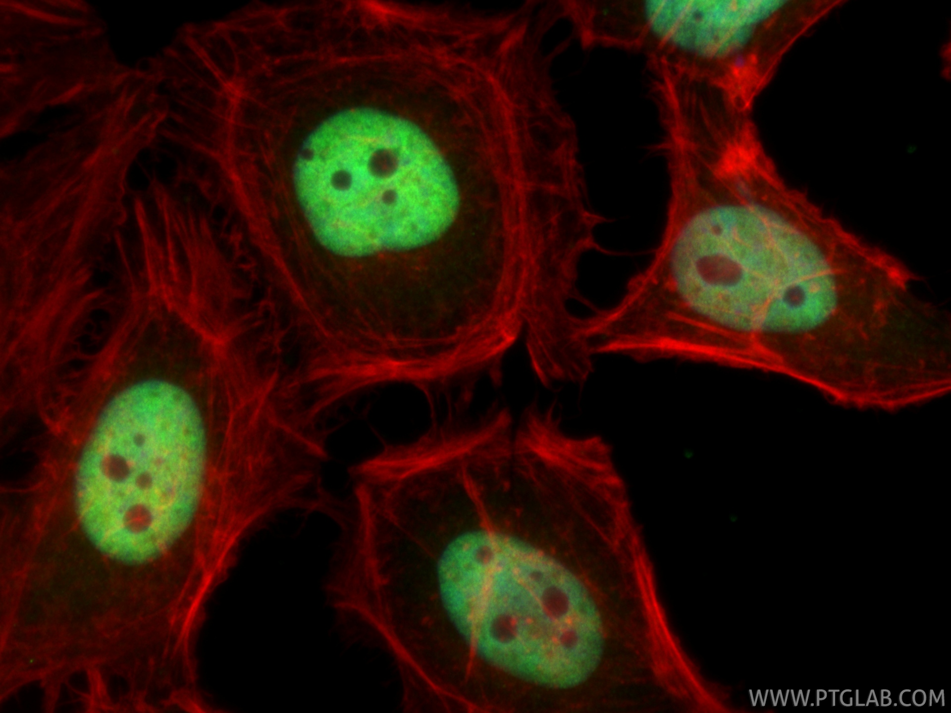 IF Staining of HeLa using 86681-2-RR (same clone as 86681-2-PBS) IF Staining of HeLa using 86681-2-RR (same clone as 86681-2-PBS)