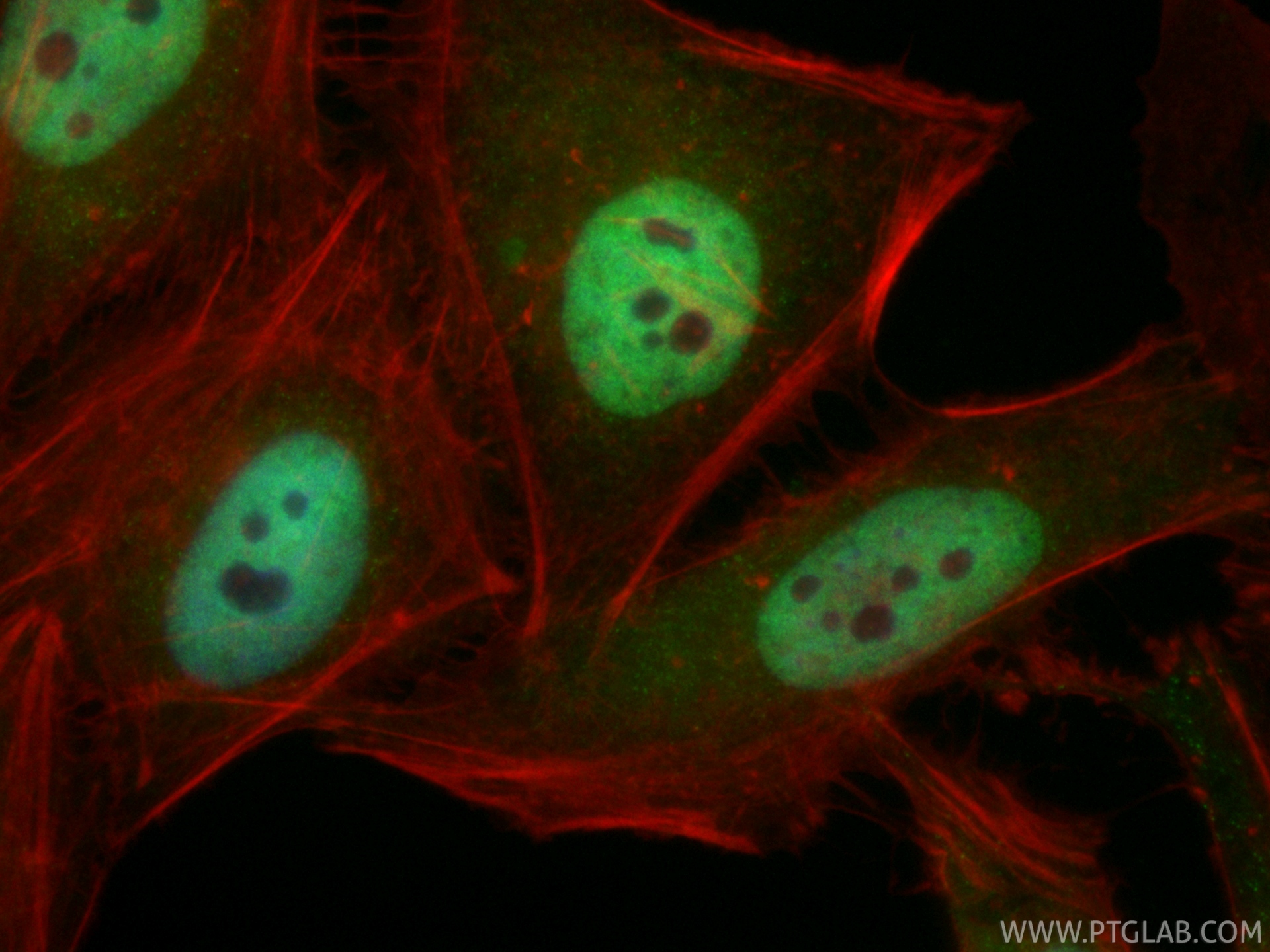 IF Staining of HeLa using CL488-86681-2 IF Staining of HeLa using CL488-86681-2