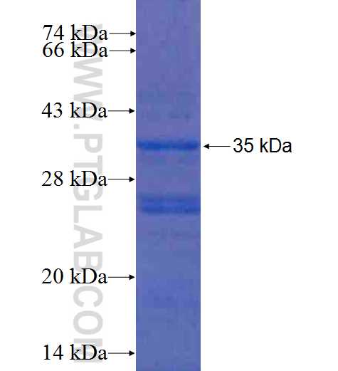 MBD3 fusion protein Ag5772 SDS-PAGE MBD3 fusion protein Ag5772 SDS-PAGE