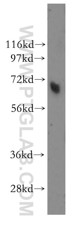 WB analysis of human skin using 11270-1-AP