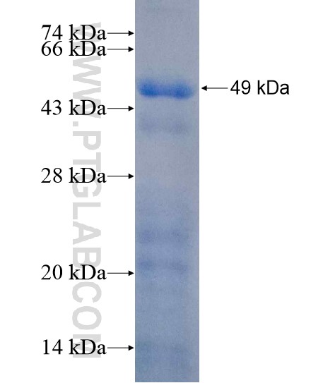 MBD6 fusion protein Ag20852 SDS-PAGE