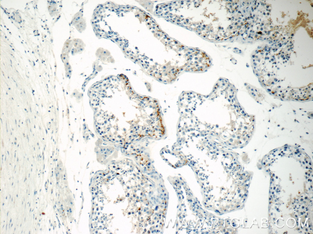 IHC staining of human testis using 10685-1-AP