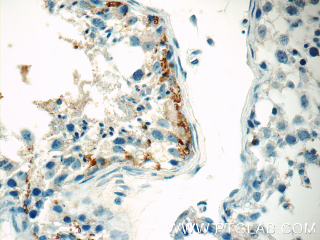 IHC staining of human testis using 10685-1-AP