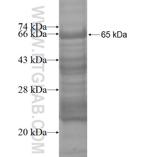 MBIP fusion protein Ag1061 SDS-PAGE