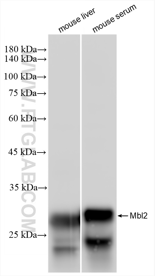 WB analysis using 85835-4-RR (same clone as 85835-4-PBS)