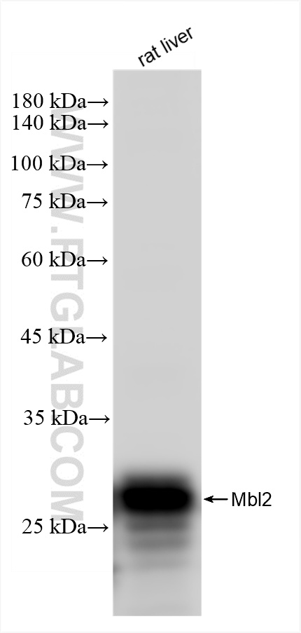 WB analysis of rat liver using 85835-4-RR (same clone as 85835-4-PBS)