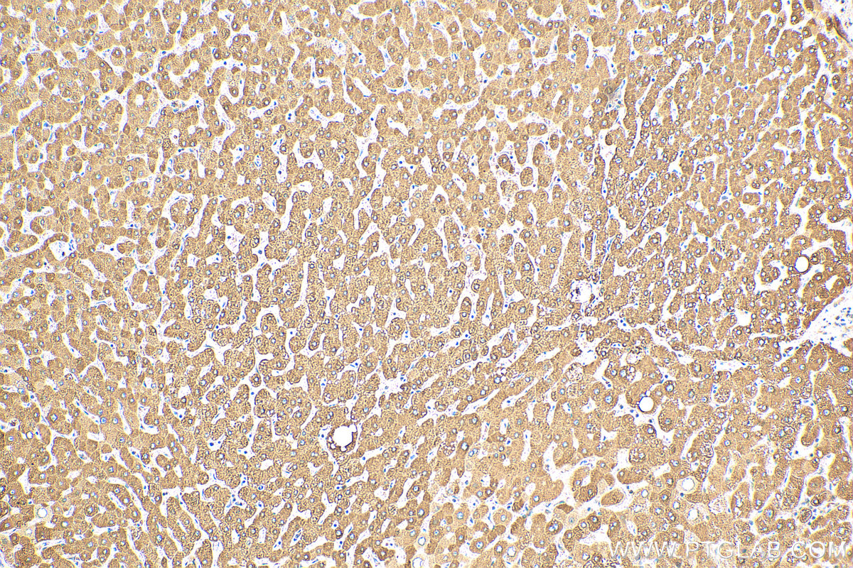 IHC staining of human liver using 24207-1-AP (same clone as 24207-1-PBS)
