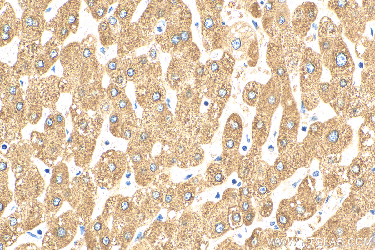 IHC staining of human liver using 24207-1-AP