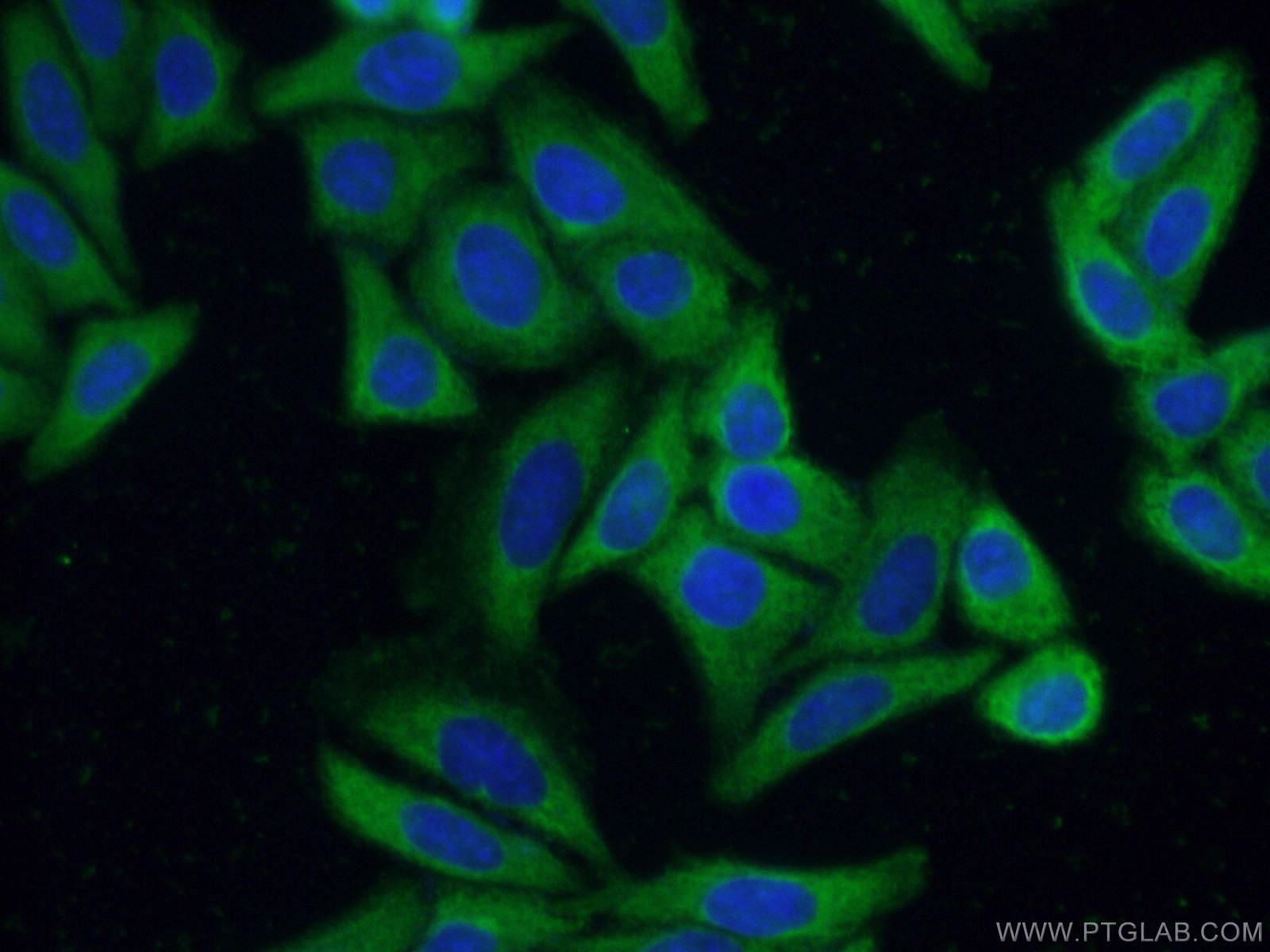 IF Staining of HepG2 using 66837-1-Ig