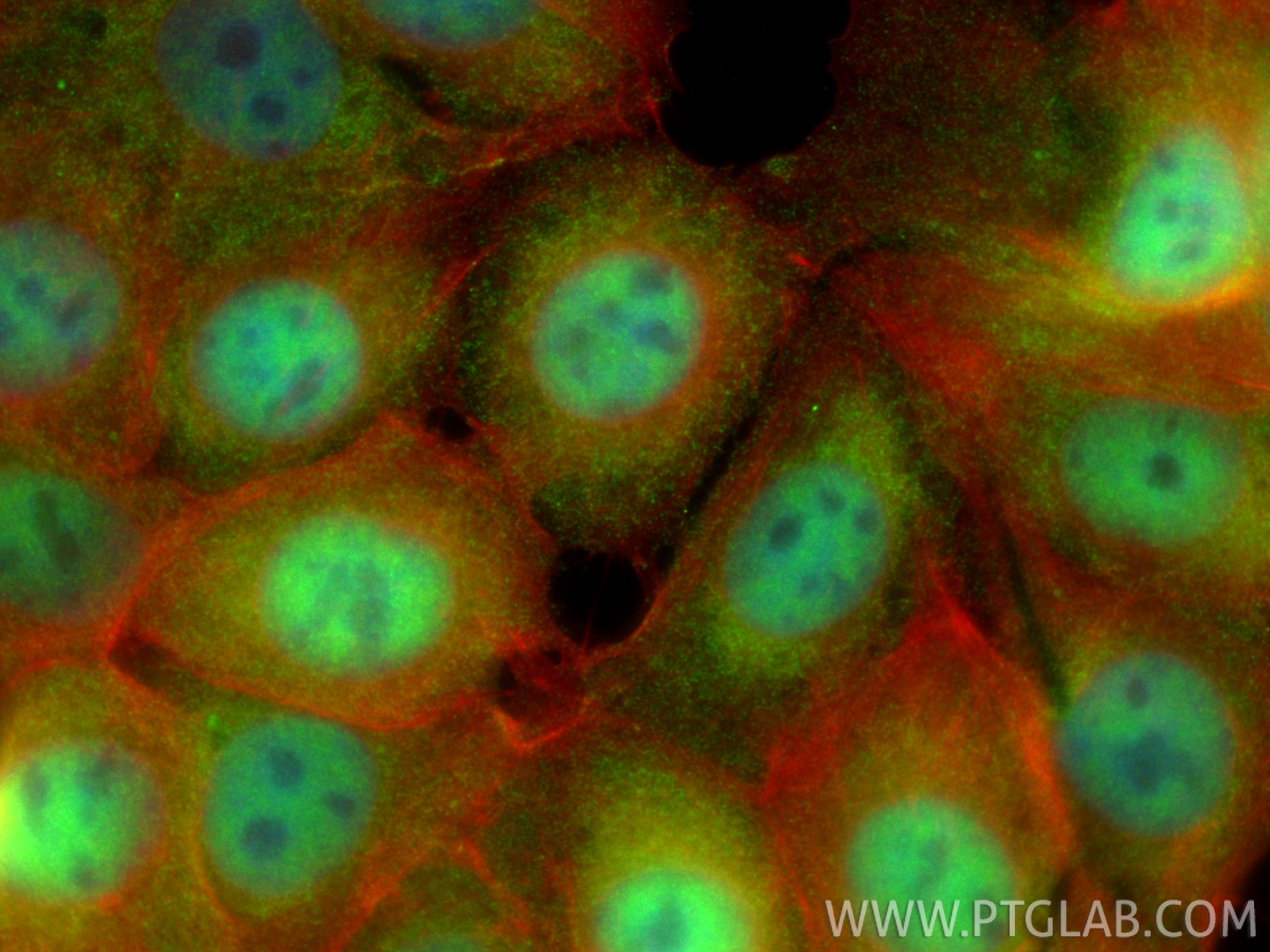 Immunofluorescent analysis of (4% PFA) fixed MCF-7 cells using MBNL1 antibody (66837-1-Ig, Clone: 1H2C12 ) at dilution of 1:400 and CoraLite®488-Conjugated Goat Anti-Mouse IgG(H+L) (<a class='green' href='/productredirect?CatalogNo=SA00013-1' target='_blank'>SA00013-1</a>), CL594-phalloidin (red). IF Staining of MCF-7 using 66837-1-Ig