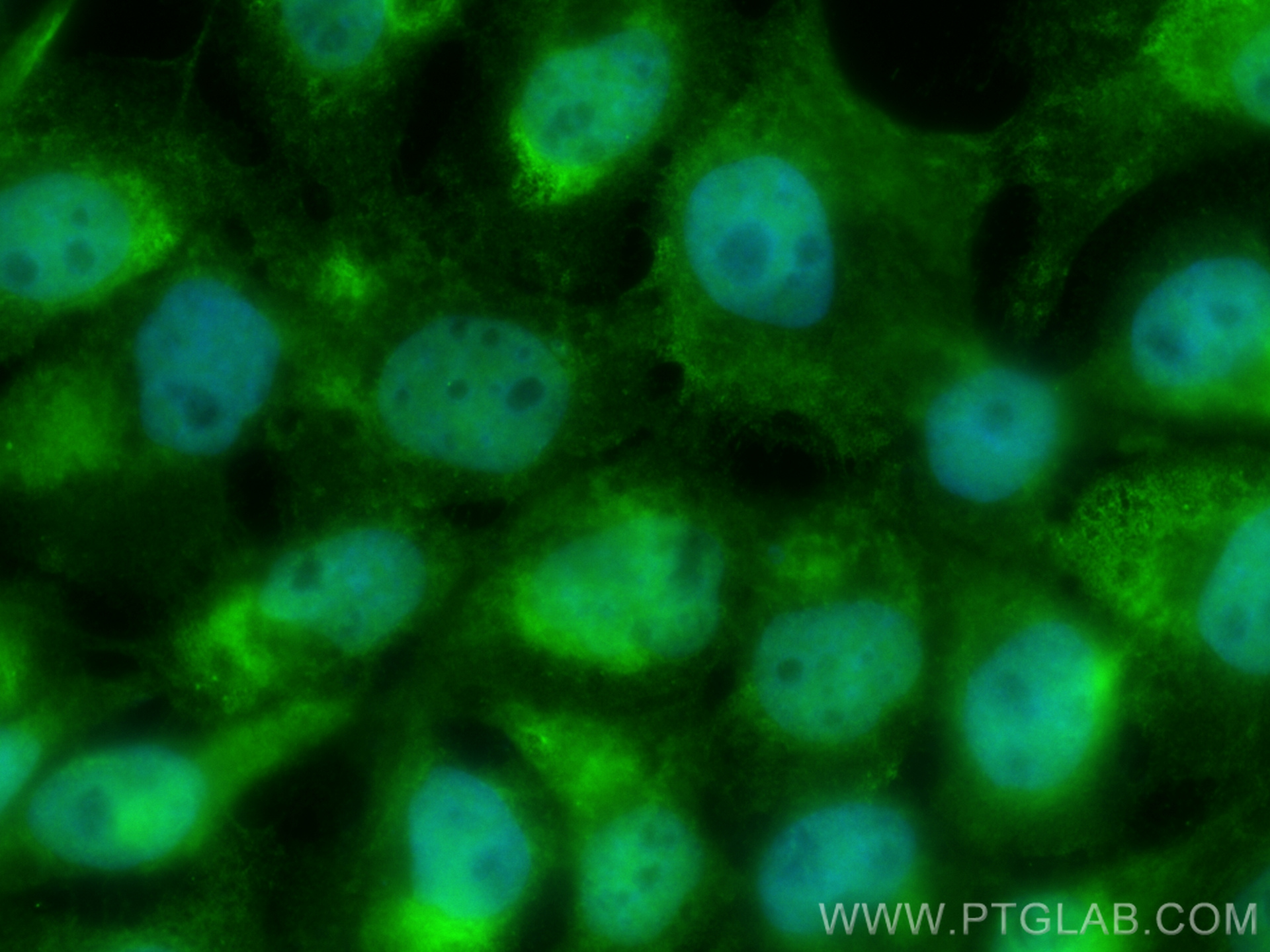 IF Staining of A431 using CL488-66837