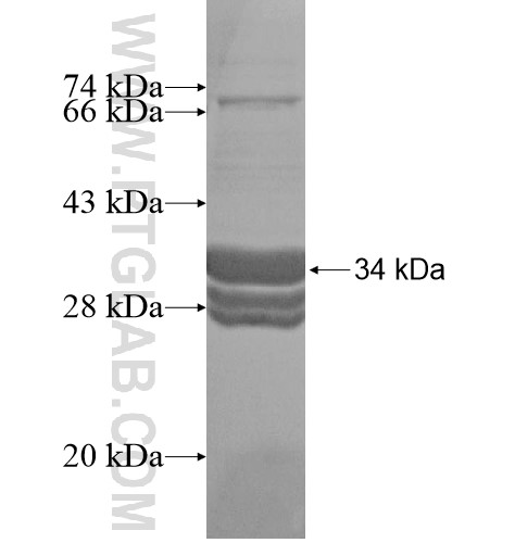 MBNL2 fusion protein Ag16035 SDS-PAGE MBNL2 fusion protein Ag16035 SDS-PAGE
