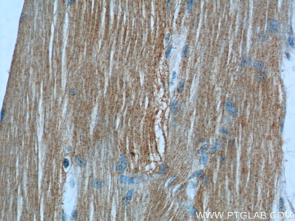 IHC staining of human skeletal muscle using 24610-1-AP