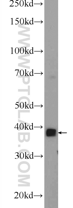 WB analysis of mouse skeletal muscle using 24610-1-AP