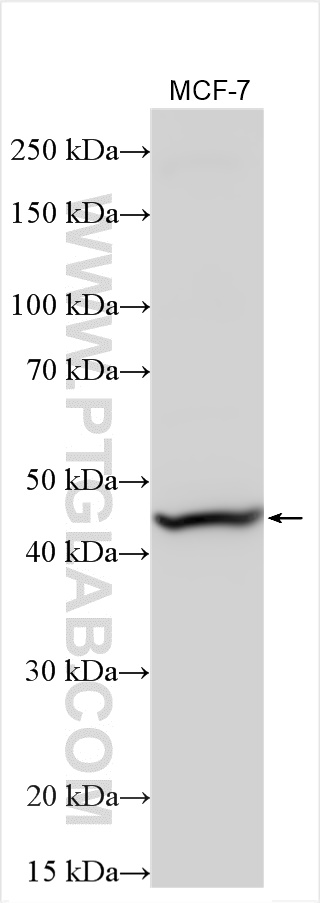 WB analysis using 25615-1-AP