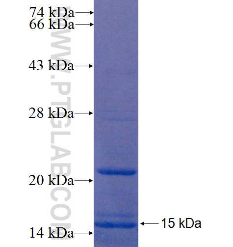 MBOAT1 fusion protein Ag22469 SDS-PAGE
