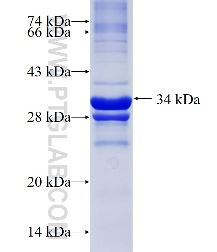 MBOAT1 fusion protein Ag22470 SDS-PAGE