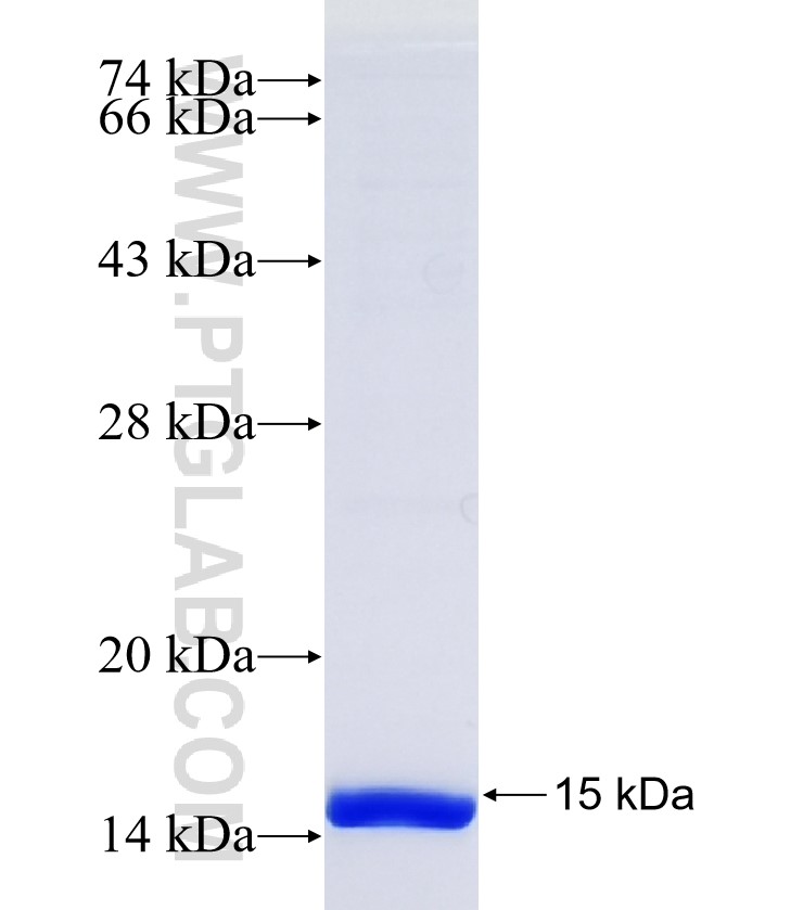 MBOAT4 fusion protein Ag37207 SDS-PAGE MBOAT4 fusion protein Ag37207 SDS-PAGE