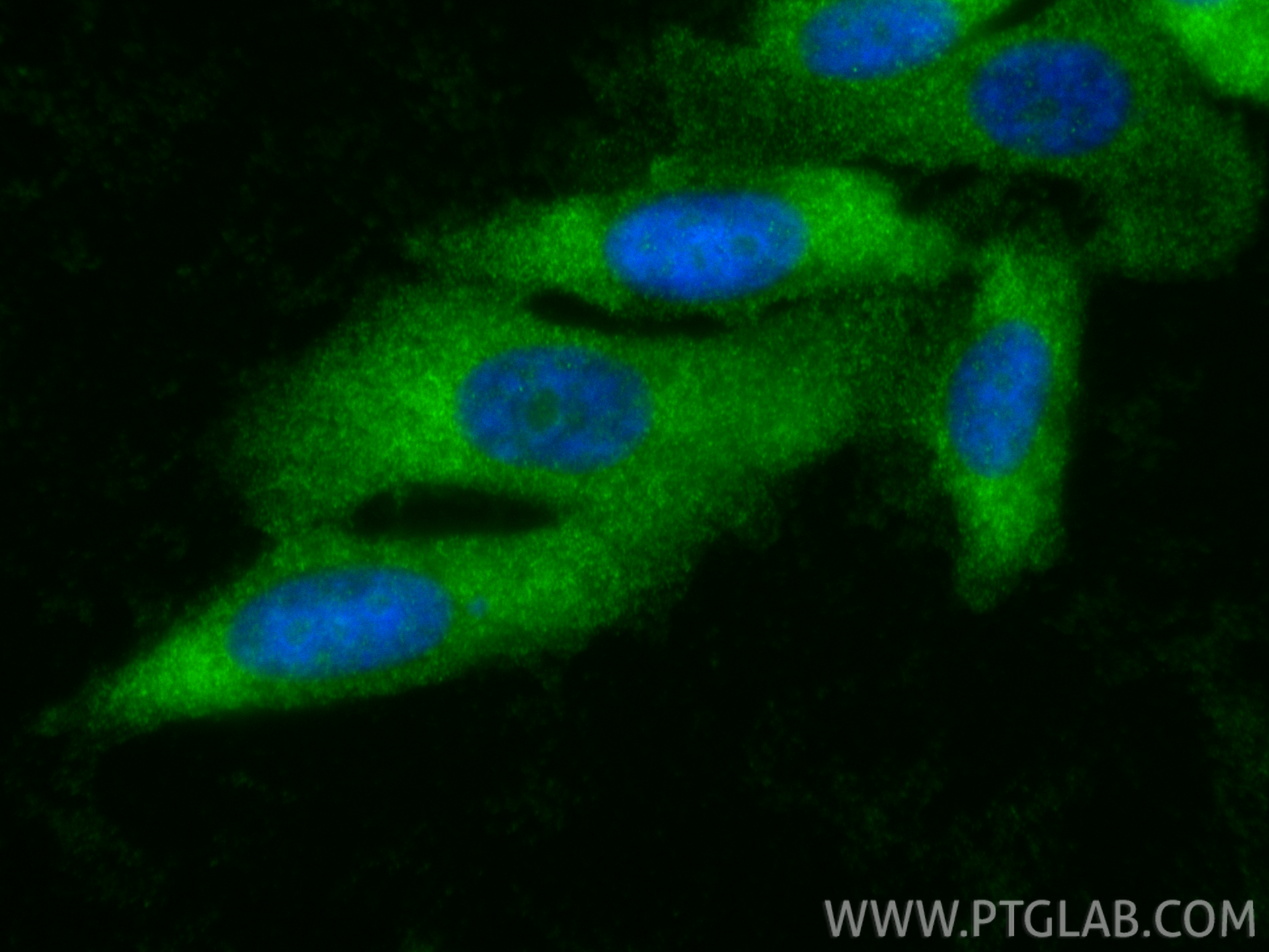 IF Staining of PC-3 using 26646-1-AP IF Staining of PC-3 using 26646-1-AP