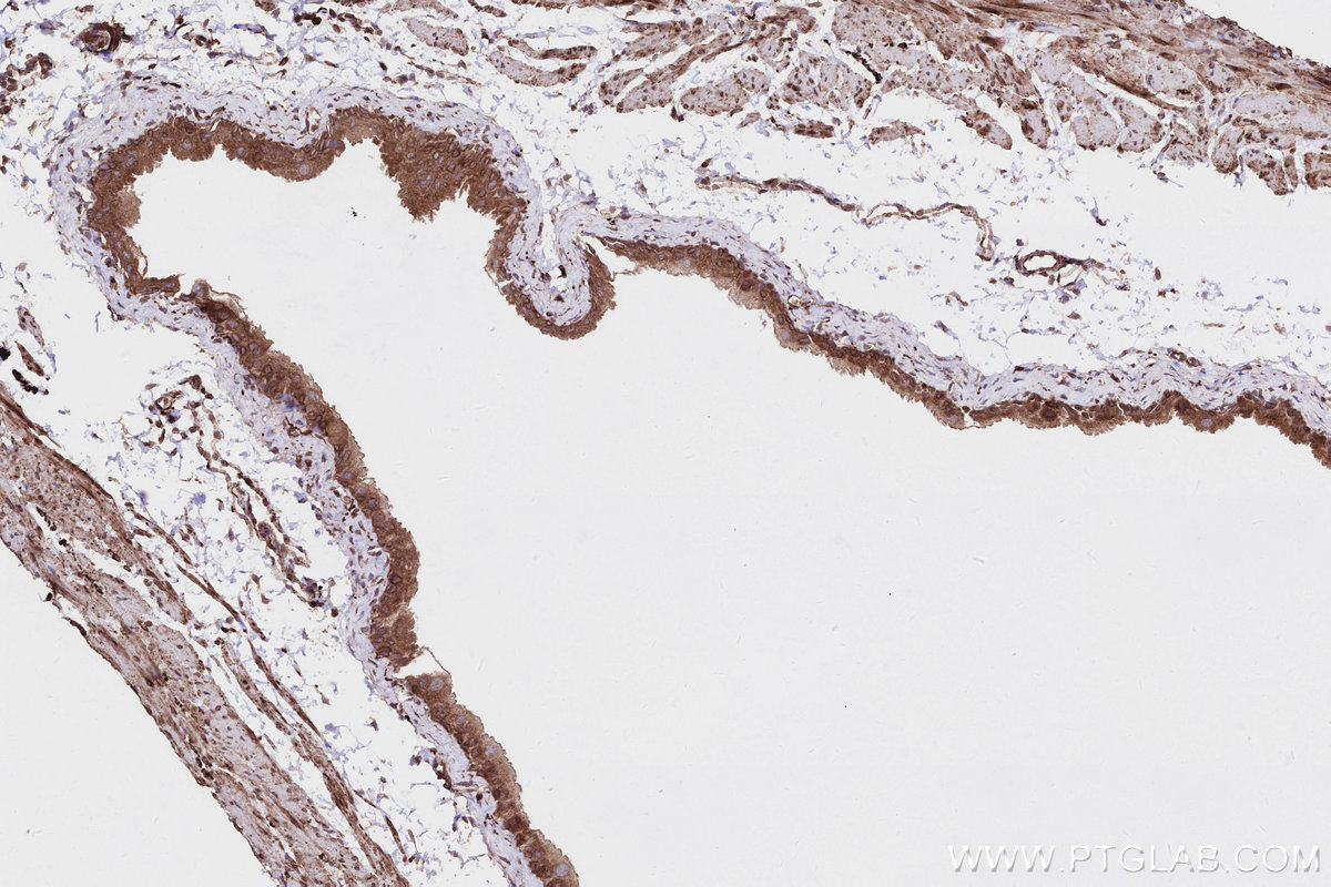IHC staining of mouse bladder using 83546-3-RR