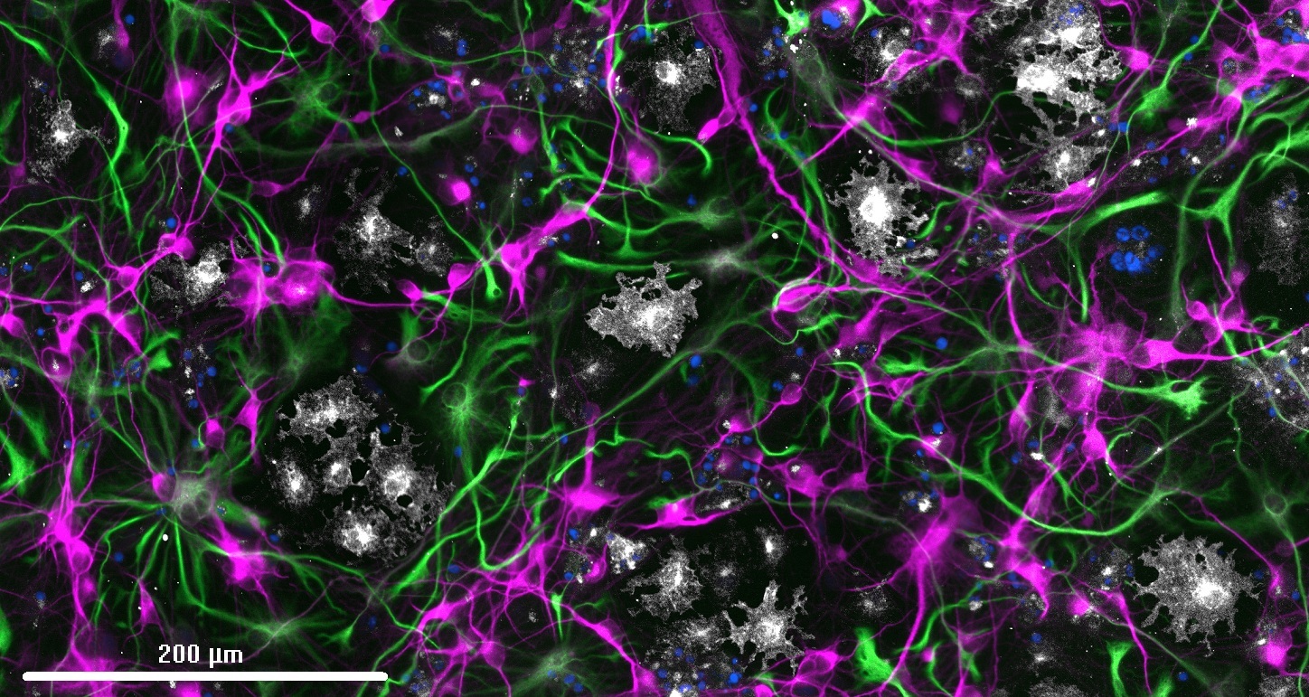 IF Staining of hiPSC using 10458-1-AP