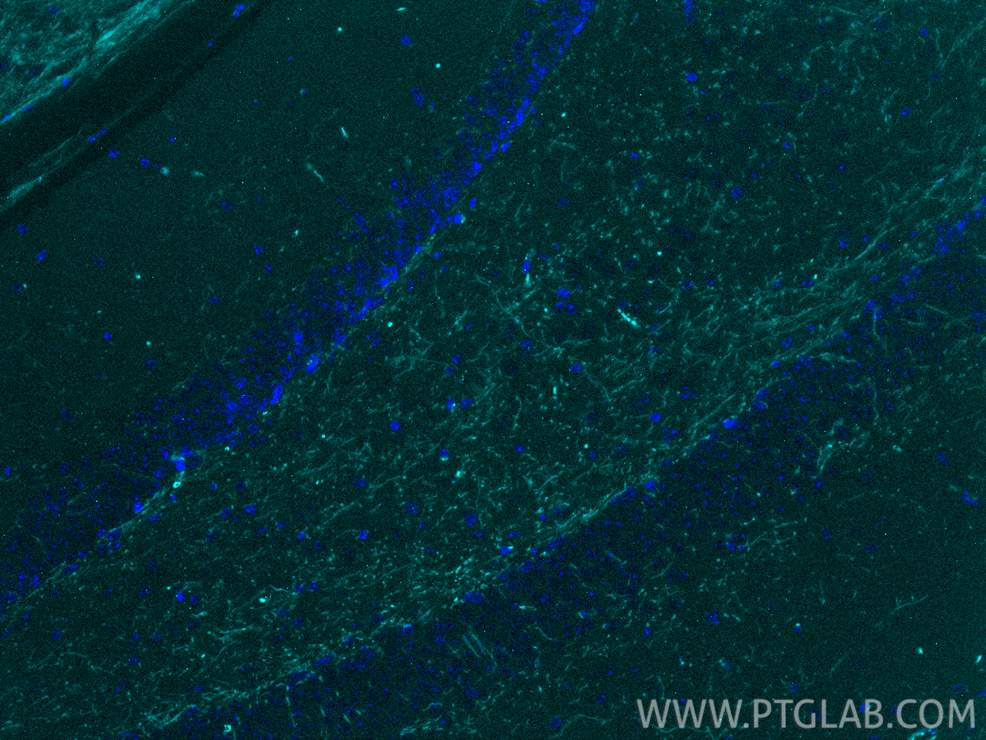 IF Staining of mouse brain using CL750-10458 IF Staining of mouse brain using CL750-10458