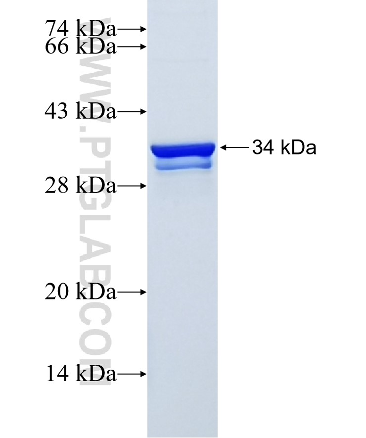 MBP fusion protein Ag0713 SDS-PAGE