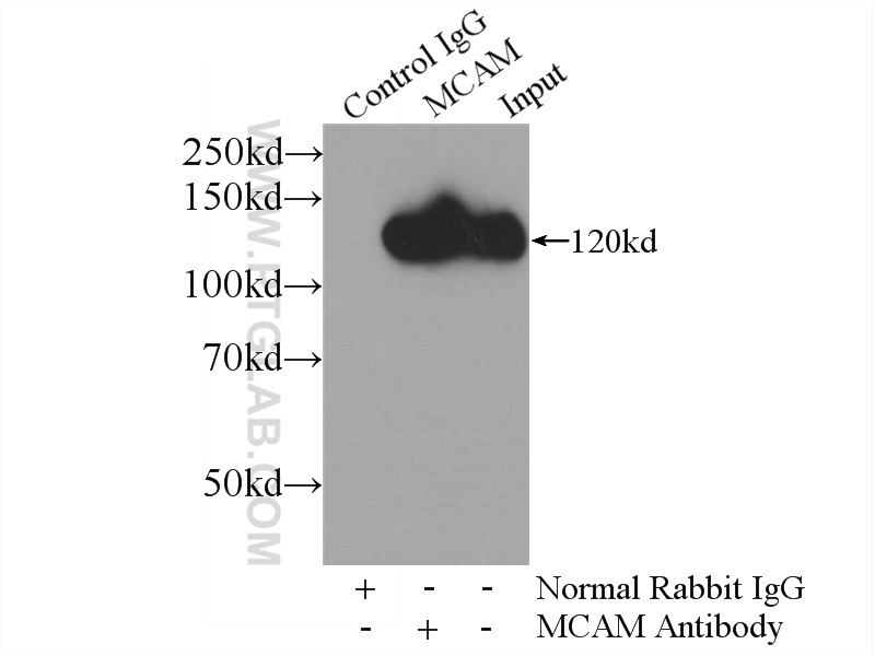 IP experiment of HeLa using 17564-1-AP