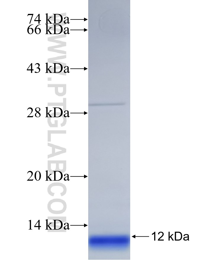 MCART1 fusion protein Ag31357 SDS-PAGE MCART1 fusion protein Ag31357 SDS-PAGE