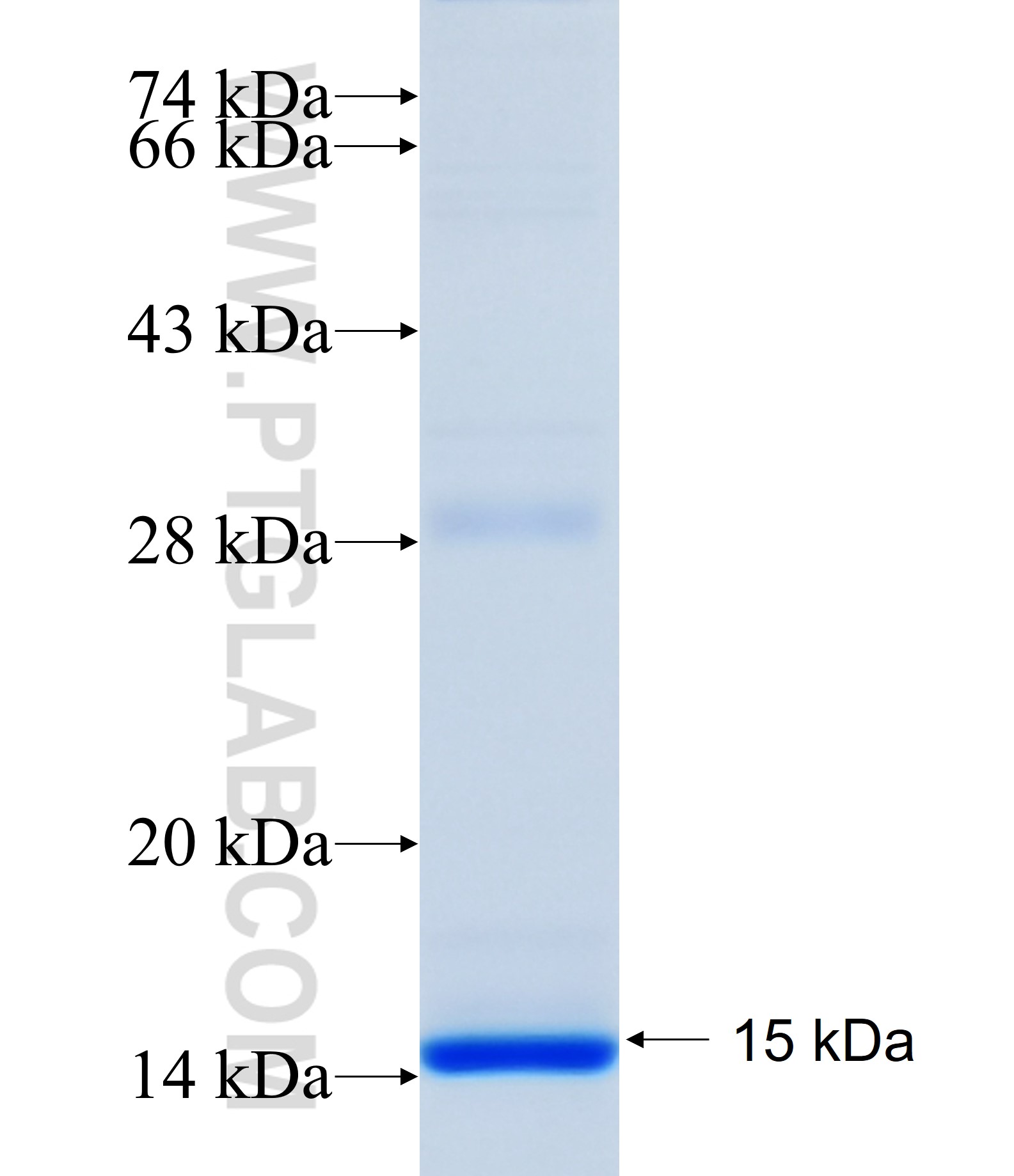 MCART6 fusion protein Ag34389 SDS-PAGE MCART6 fusion protein Ag34389 SDS-PAGE
