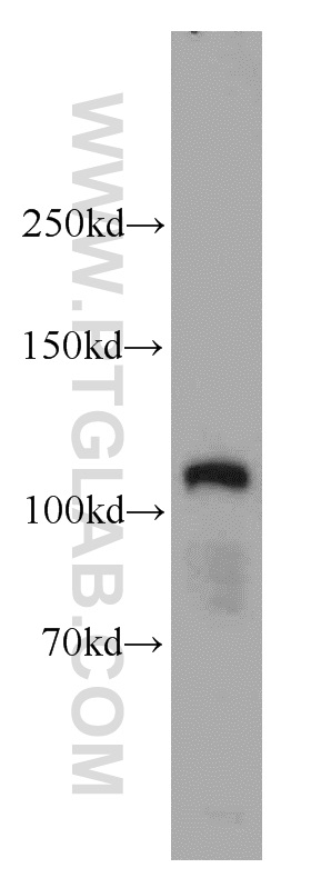 MCC Polyclonal antibody