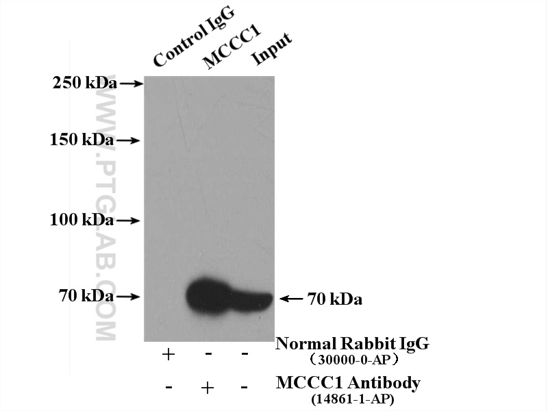 IP experiment of mouse liver using 14861-1-AP