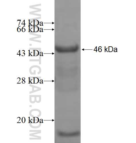 MCCC1 fusion protein Ag6789 SDS-PAGE MCCC1 fusion protein Ag6789 SDS-PAGE