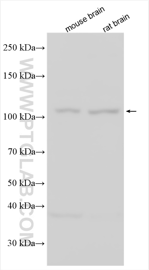 WB analysis using 27110-1-AP WB analysis using 27110-1-AP