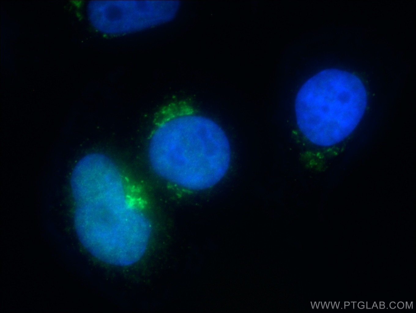 IF Staining of HepG2 using 13068-1-AP