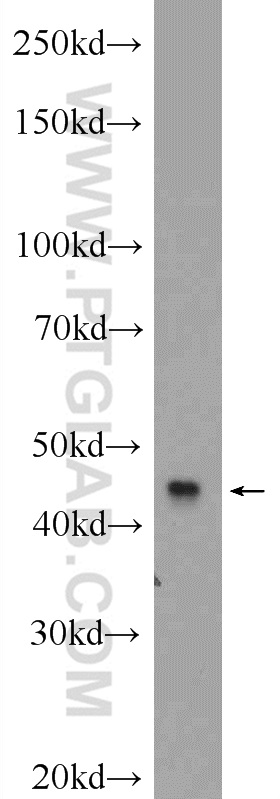 WB analysis of SH-SY5Y using 11656-2-AP