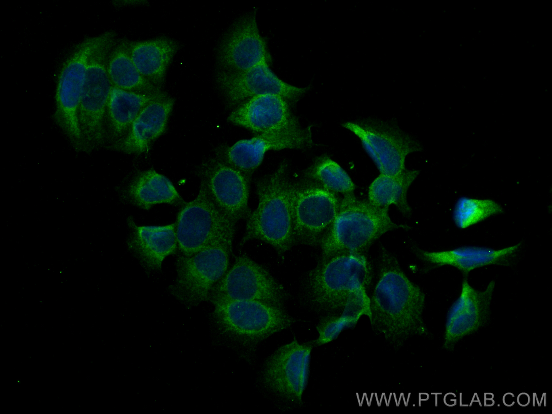 IF Staining of MCF-7 using 16225-1-AP