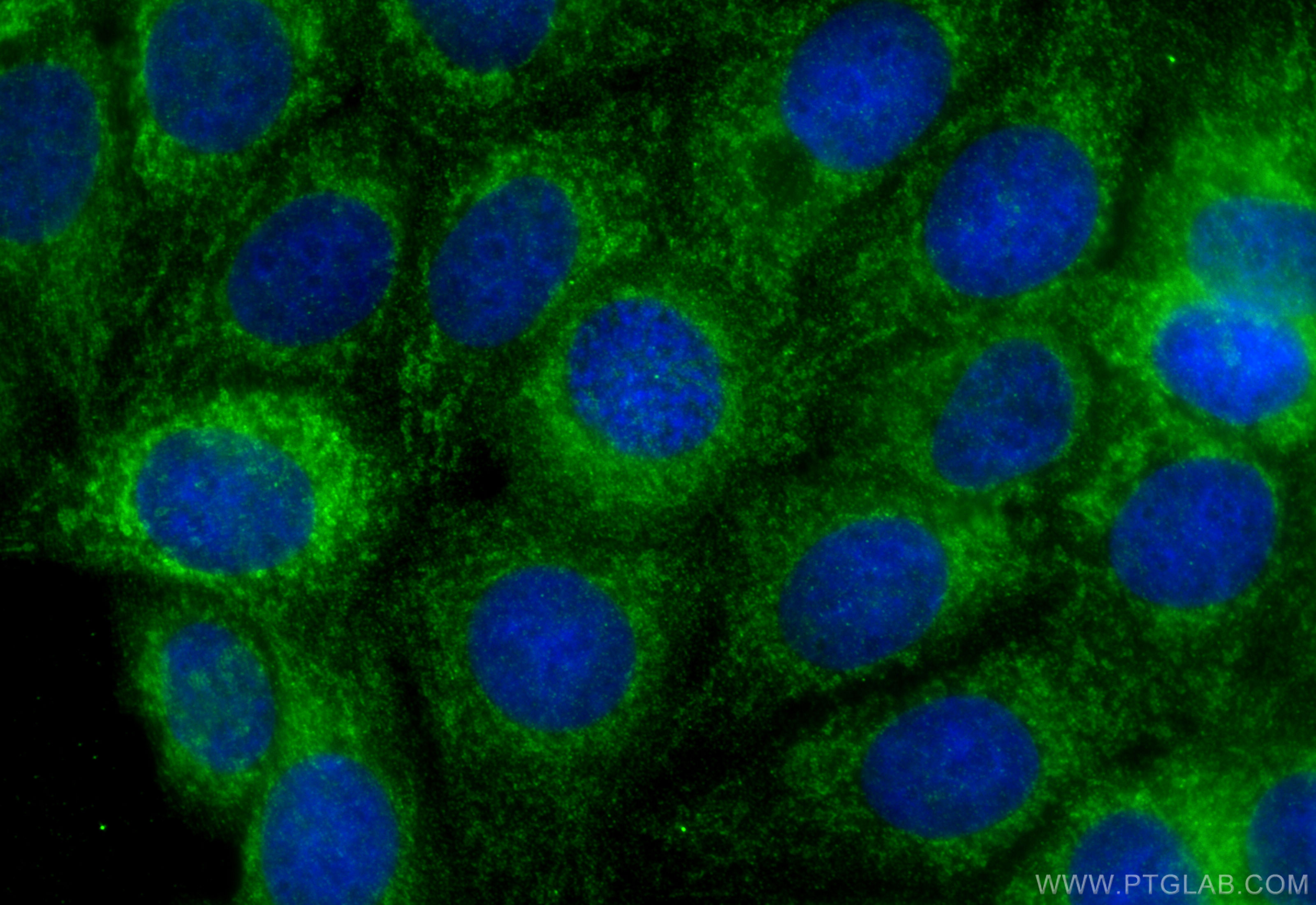 IF Staining of MCF-7 using 16225-1-AP