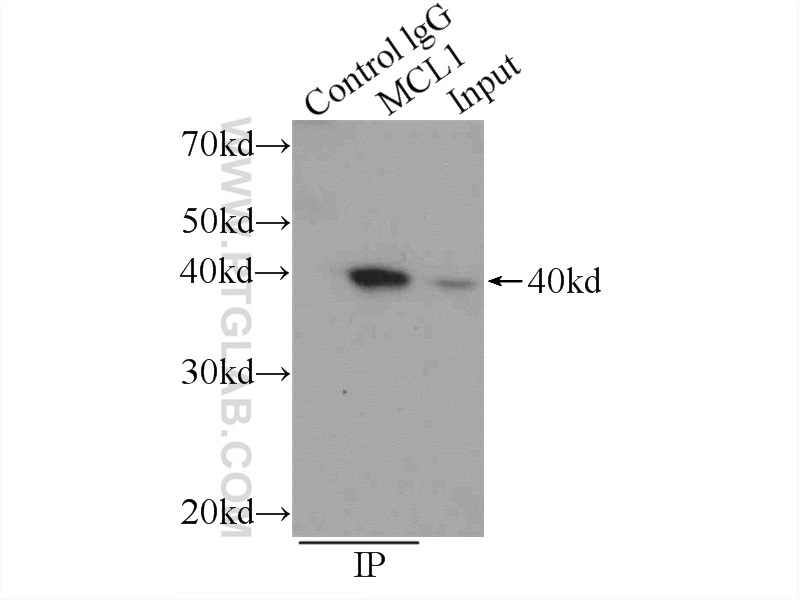 IP experiment of Raji using 16225-1-AP