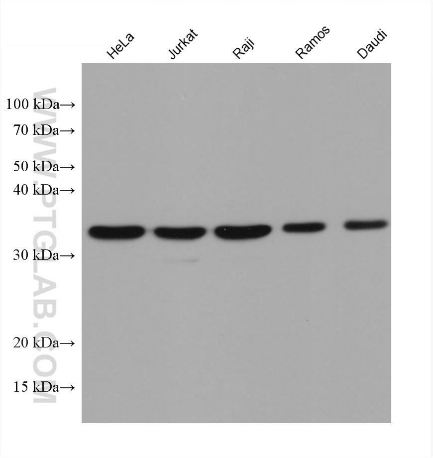 WB analysis using 66026-1-Ig